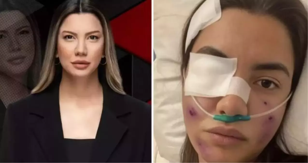 Fulya Öztürk Kaza mı Geçirdi? Gerçeği Bizzat Kendi Açıkladı!